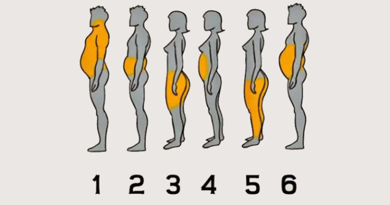 Fd