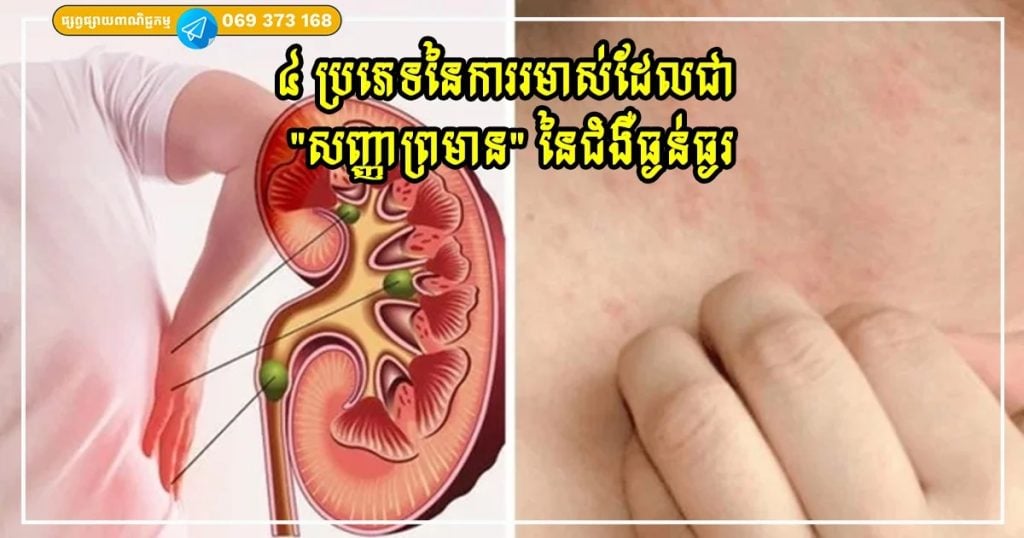 រមាស់មិនធម្មតា៖ ៤ ប្រភេទដែលអាចជាសញ្ញានៃជំងឺខាងក្នុង