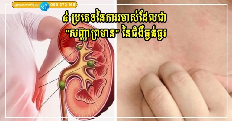 រមាស់មិនធម្មតា៖ ៤ ប្រភេទដែលអាចជាសញ្ញានៃជំងឺខាងក្នុង